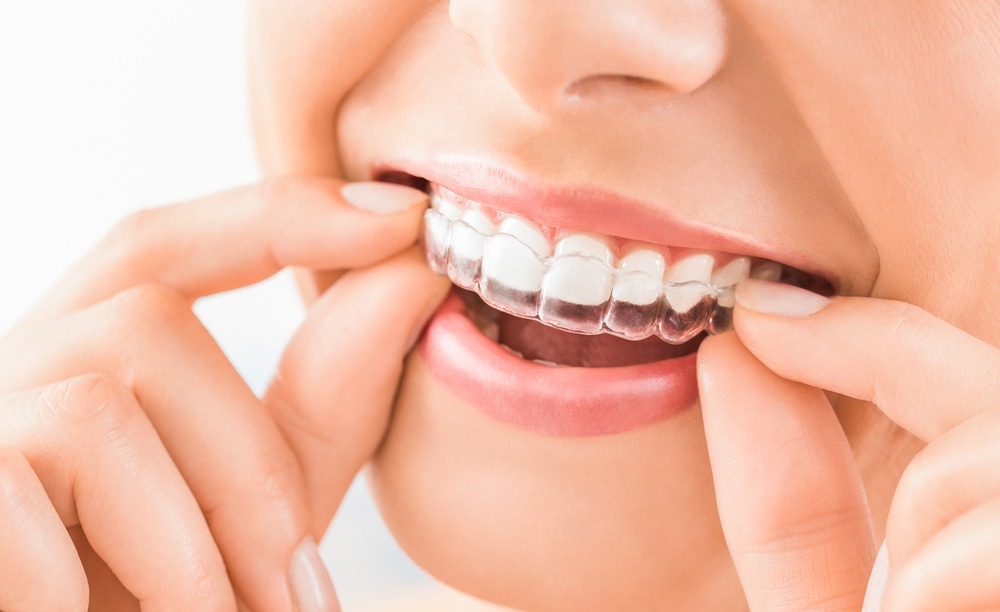 orthodontist in New York city | Invisalign dentist nyc