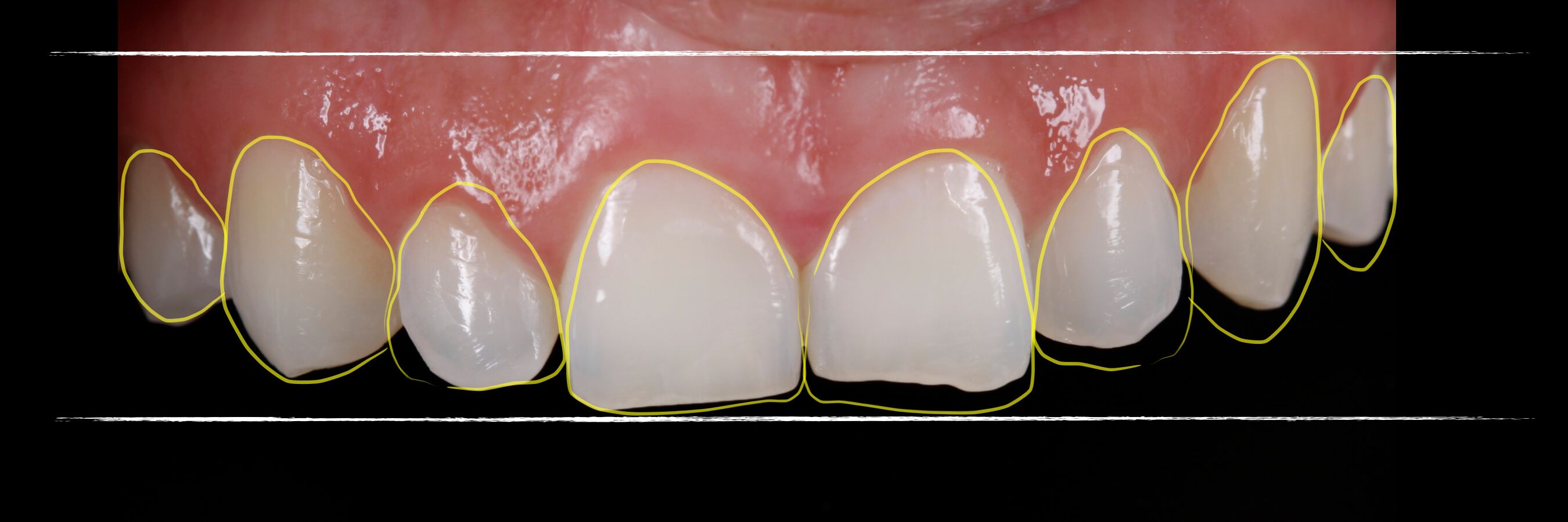 AUpcXI8q JBL New York City Smile design