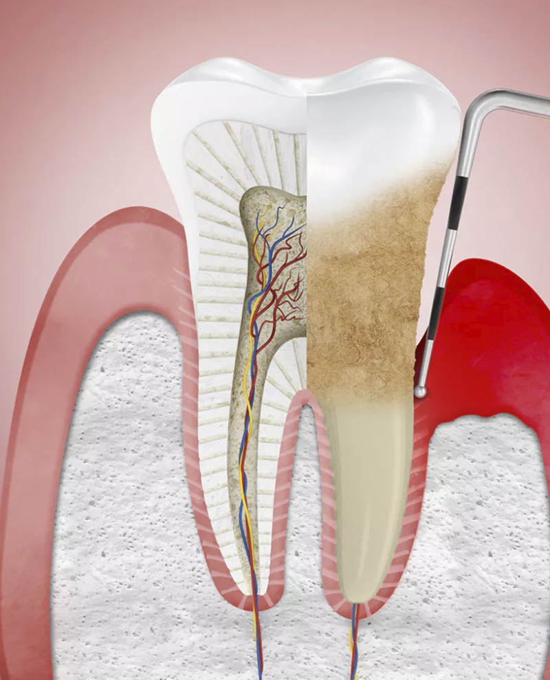 endodontics nyc