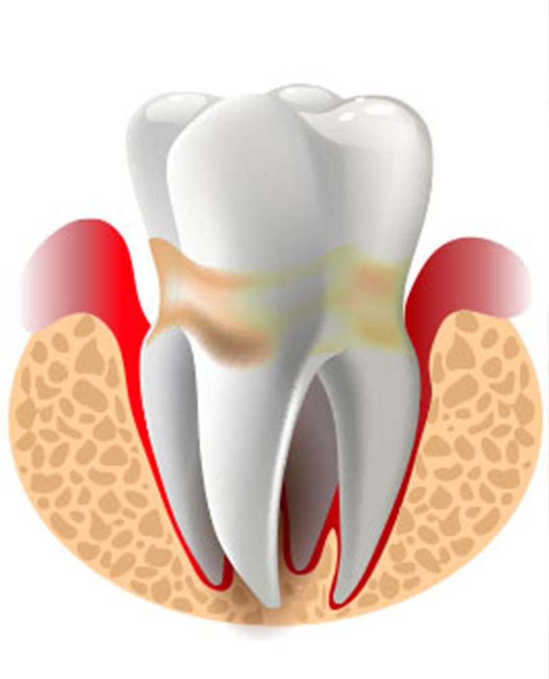 calcium and oral health | dental crown replacement nyc