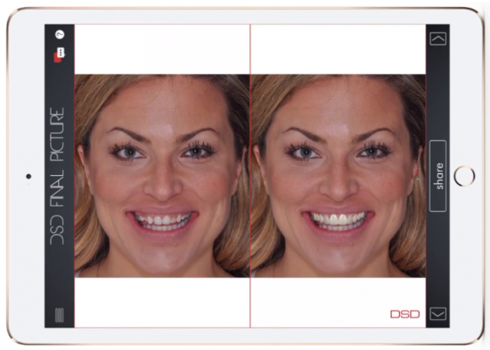 vlcsnap-2019-07-16-16h15m24s933-1024x907 JBL New York City Digital Smile Design