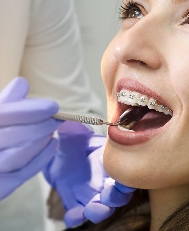 woman with braces