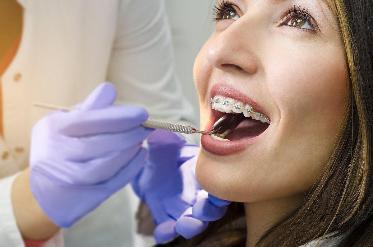 woman with braces
